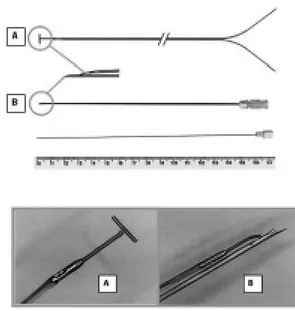 Figure 1 shows the new lead illustrating in detail its tip with a “T-shape” bar, to be inserted on the fetal myocardium.