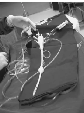 Fig. 1 – Catheter utilized during decalcification of the aortic valve with the heart arrested