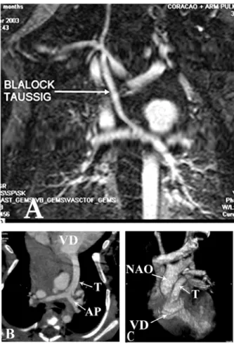 Figure 1 shows images resulting from the two surgical techniques used.