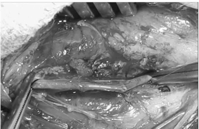 Fig. 1 – Final appearance of the arterial anastomosis