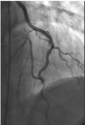 Fig. 6 – The comfortable positioning of the left handed surgeon