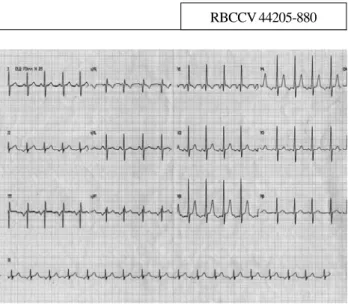 Fig. 1 – Eletrocardiograma pré-operatório