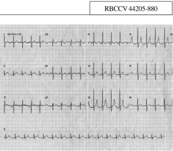 Fig. 1 – preoperative echocardiogram