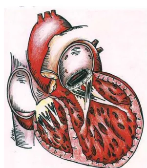 Fig. 3 – Postoperative echocardiographic image showing the crossing of the papillary muscles