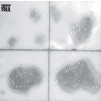 Fig. 2 – Embolic matter captured in the intra-aortic filter of patient 1 (magnification 10x - each square represents 3 mm)