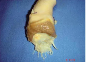 Fig. 1 – Decellularized aortic homograft