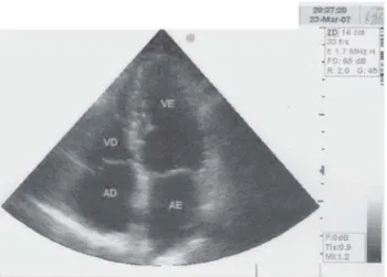 Fig. 4 – Control echocardiographic study performed 93 months after the tumor resection