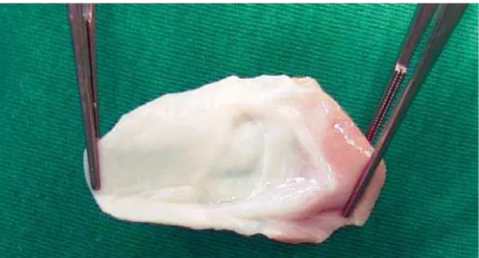 Fig. 2 – Decellularized homograft monocuspid prepared for implantation in the anterior wall