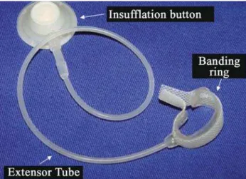 Fig. 1 – PT adjustable banding device used in the protocol, manufactured by SILIMED (Rio de Janeiro)