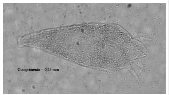 Figura 1 - Oxycenus maxwelli.(Keifer, 1939) (foto microscópio com aumento de 100x) (foto: Ricalde, M.P.).