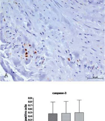 Fig. 2 - Representative photomicrograph of immunohistochemical analysis for expression of caspase 8 in segments of vein submitted for fifteen seconds at 300 mmHg (A): original magnification 400X.
