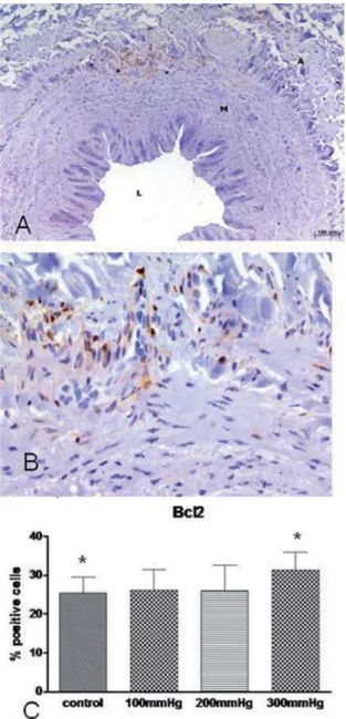 Fig. 4 - Representative photomicrographs of immunohistochemical analysis for expression of Bcl-2 in segments of vein submitted for fifteen seconds at 300 mmHg (A): original magnification 100X; (B):