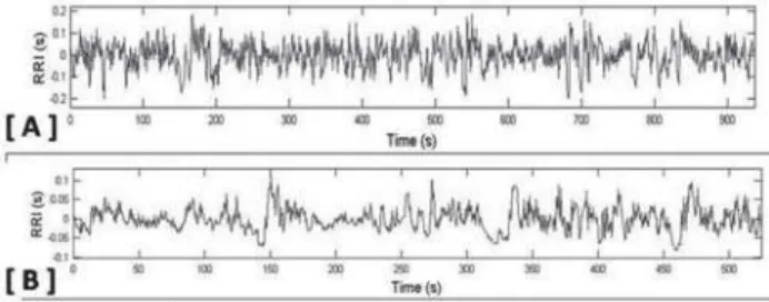 Figure 1 shows rate tachogram obtained from the RR intervals of a normal young adult and a normal newborn