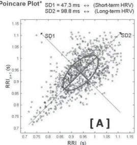 Fig. 2 – Poincaré chart of a normal young adult (A) and a normal newborn (B). The dispersion of both short- (SD1) and long-term in panel B (SD2) is smaller than in panel A