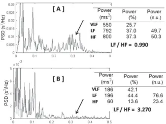 Fig. 3 - Spectral analysis of frequencies (Fast Fourier Transform) of a normal young adult (A) and a normal newborn (B)