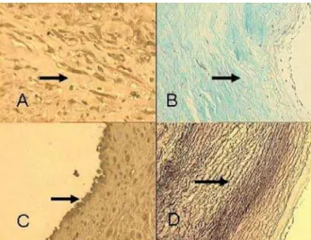 Fig. 4 - Histological analysis by optical microscopy of the decellularized grafts. Photomicrographs of histological suturing of the pulmonary conduit, cryopreserved homograft, at 40x magnification