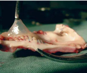 Fig 1 - Photograph showing translucent appearance and integrity of decellularized homograft leaflets explanted after 180 days