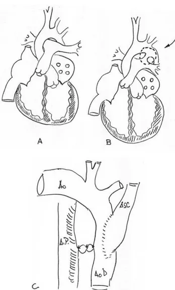 Fig. 1 – Desenhos de Danton Rocha Loures. A) Coração normal;