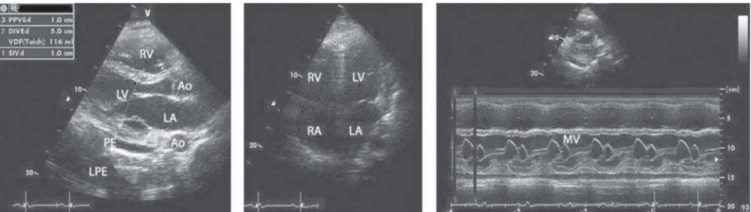 Fig. 3 - A light to moderate interstitial mononuclear infiltrate and interfibrilar edema (HE), different magnifications