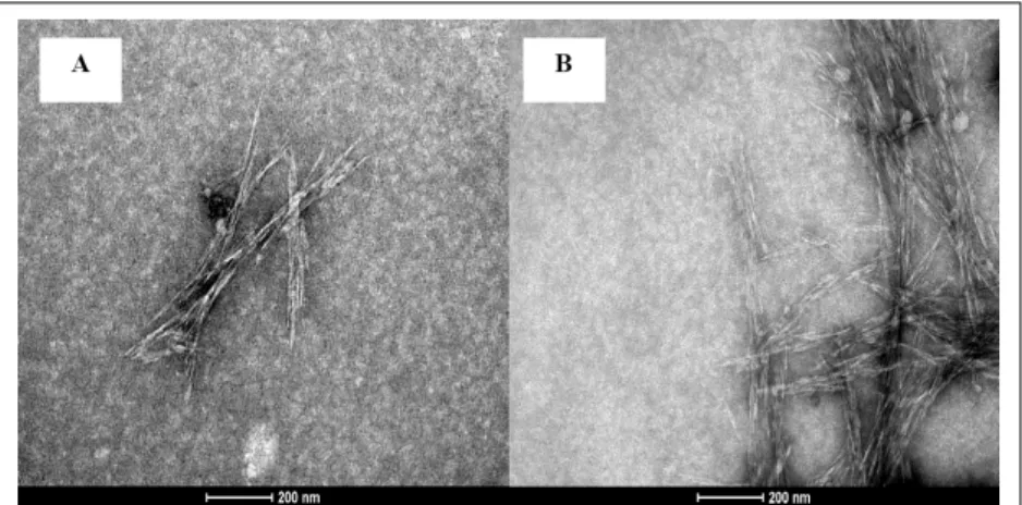 Figura 1 - Micrografias obtidas a partir da solução de nanocelulose de coco para confirmar a presença dos nanocristais
