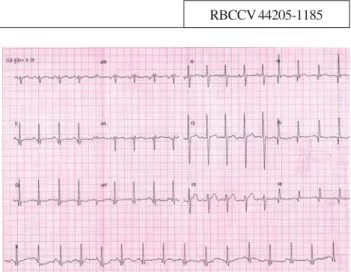 Fig. 1 - Preoperative electrocardiogram