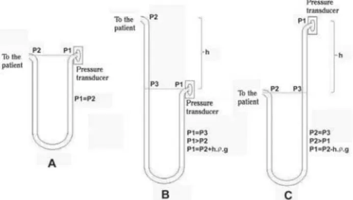 Figure 1A shows common circuit of pressure measurement performed with a combination of a liquid column manometer (extensor) and a pressure transducer.