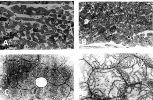Fig. 5 - Light (A, B) and electron (C, D) micrographs of transverse sections of the myocardium of rabbits submitted to cardioplegic cardiac  arrest