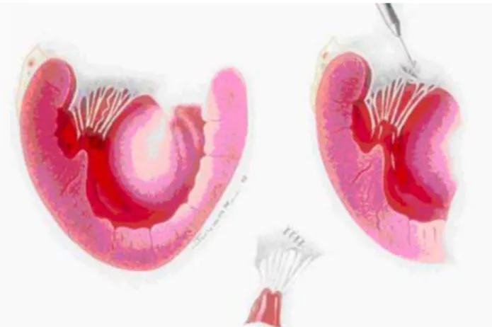Fig. 1 – Left: schematic illustration shows the elongated chordae.