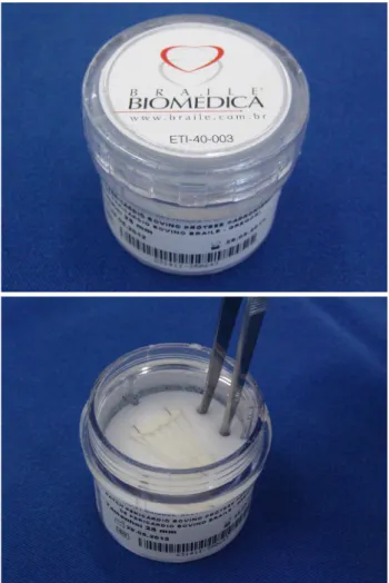 Fig. 8 – Measuring instruments ranging in length from 20 to 35 mm are used to confirm standardization of the chordae