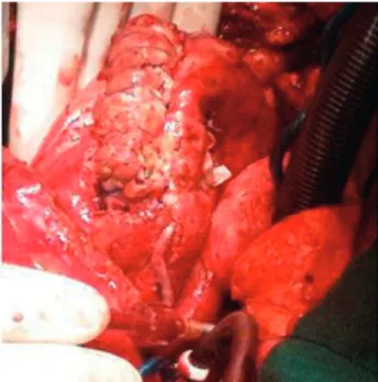Fig. 2 – Final surgical aspect