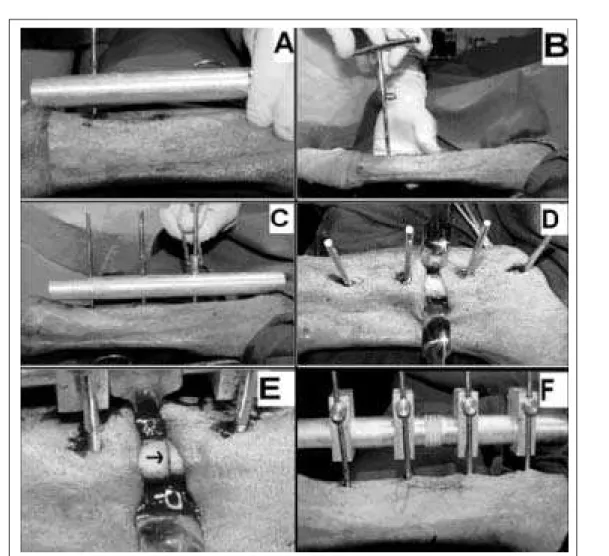 Figura 2 - Procedimento cirúrgico. Utilização de um guia gabarito para a passagem dos fios (pinos) (A); passagem dos fios (B e C); acesso cirúrgico para a osteotomia (D); osteotomia na diáfise da tíbia (E); osteotomia reduzida com fixador externo flexível 