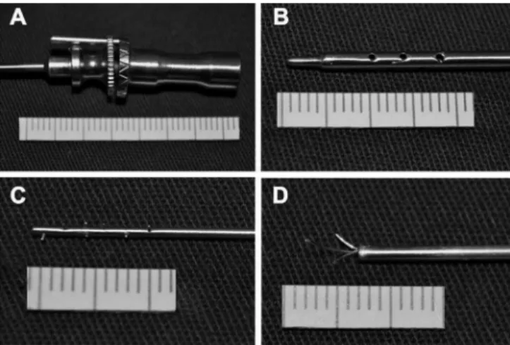 Fig. 1 – Schematic presentation. The instrument has a locking  mechanism (1,2,3) and is composed of an external needle with blunt  tip, with multiple 0.5 mm diameter holes (4,5)