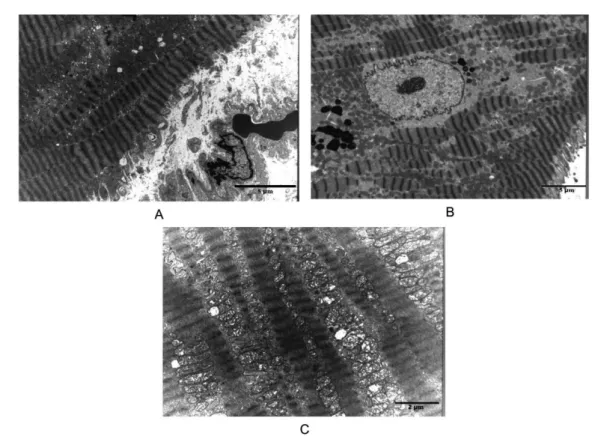 Table 4.  Cellular and mitochondrial quantitative frequencies of alterations in both groups