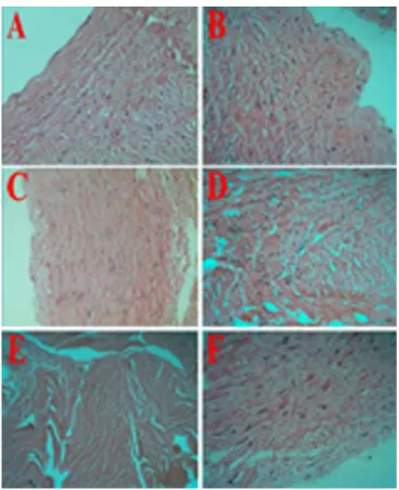 Fig. 2 - Kaplan-Meier analysis revealed that the pathological  changes of the left internal mammary graft artery were a risk factor  that negatively inluenced the survival rate