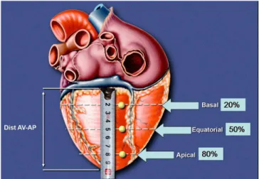 Fig. 1 - Posterior view of a heart with schematic delimitation of dots  for ventricular lamination