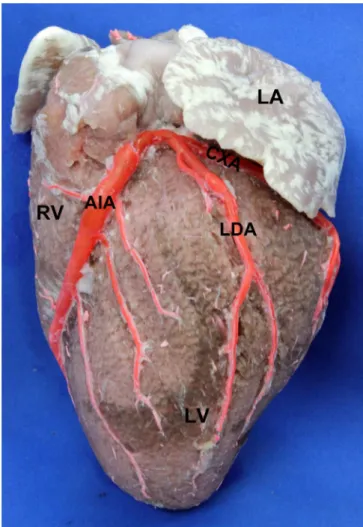 Fig. 1 - Obtuse edge of the heart. 