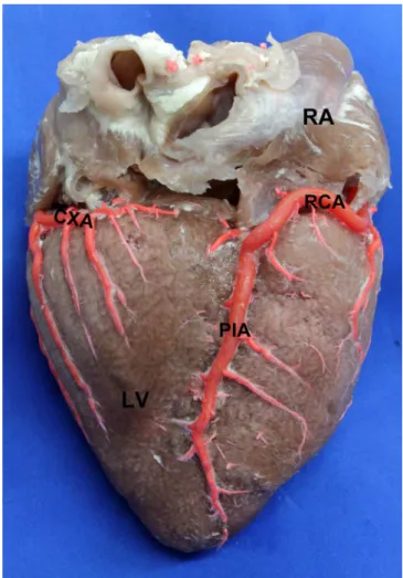 Fig. 5 - Obtuse edge of the heart. 