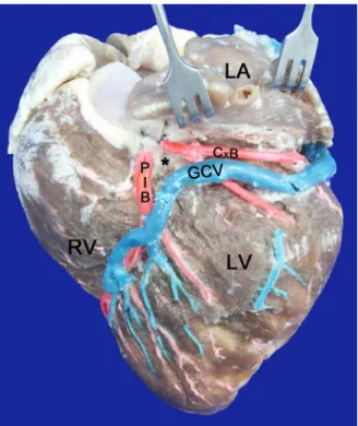 Fig. 2 - Left surface of the heart. LA=Left Atrium; LV=Left Ventricle; 