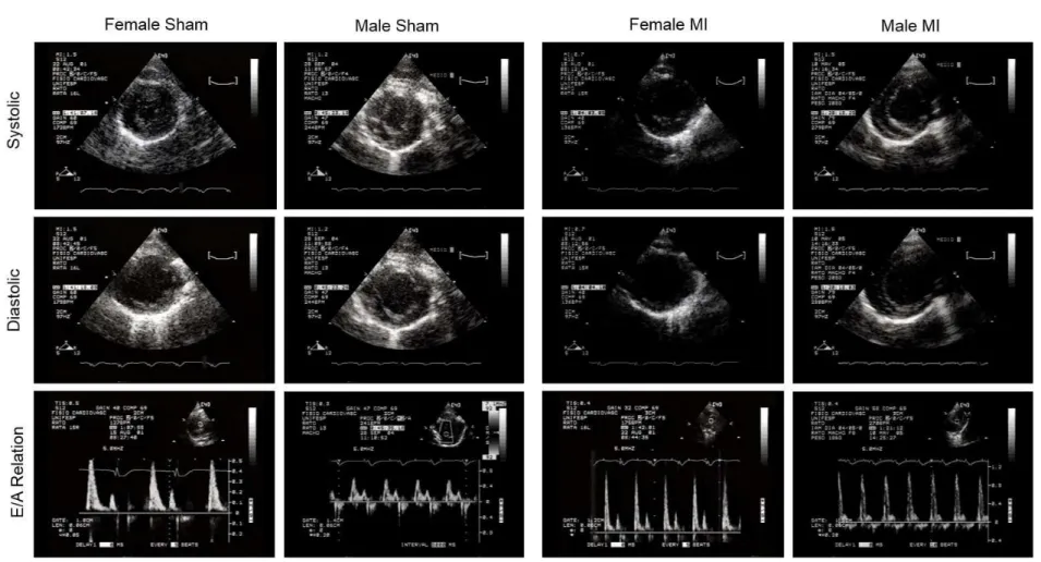 Fig. 1 - Illustrative example of two-dimensional mode traces of the left ventricle (LV) of the female and male rats