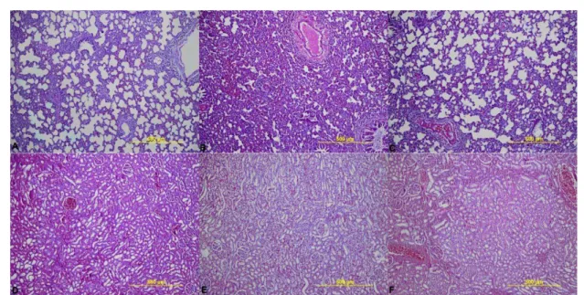 Fig. 4 - A and D show renal and lung tissues samples of the sham group and there were no pathological changes