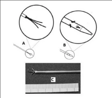 Fig. 4 - The instrument is easily visualized.  A –  Echocardiography; 