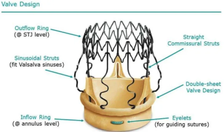Fig. 2 - Perceval structure (courtesy LivaNova).