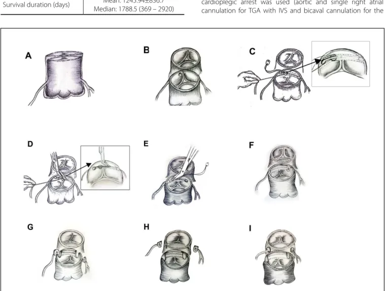 Fig. 2 – Anatomical patterns of the coronary arteries. 