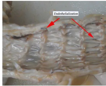 Fig. 6 - Thoracic aorta implanted with stent-graft.