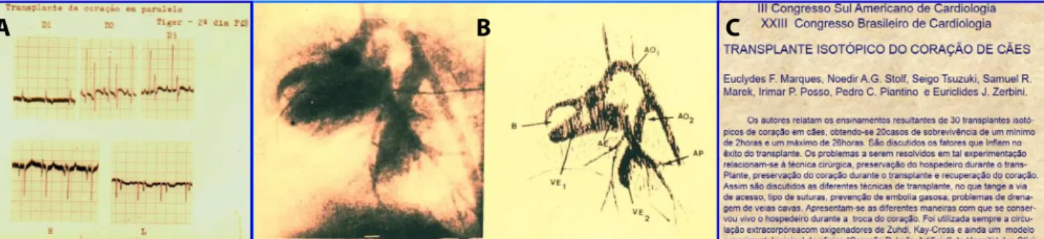 Fig. 8 - Photograph of preparation of the donor for the first Brazilian 