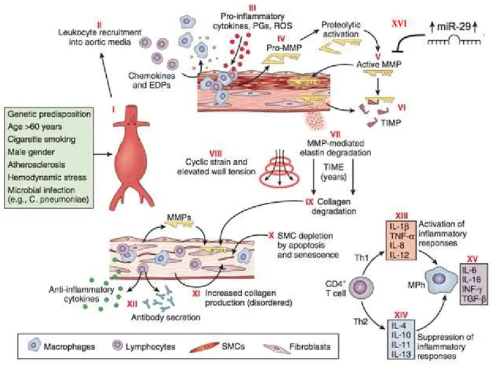 Fig. 3 - Pathophysiology of abdominal aortic aneurysms. Schematic diagram illustrating events thought to contribute to the development  and progression of abdominal aortic aneurysms