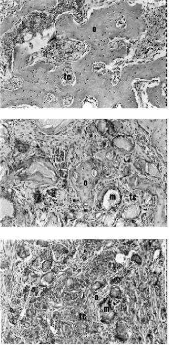 Figure 3. Histological section of rat alveoli 42 days after dental extraction of the control group (top), HA group (middle) and HA/BMPs group (bottom)