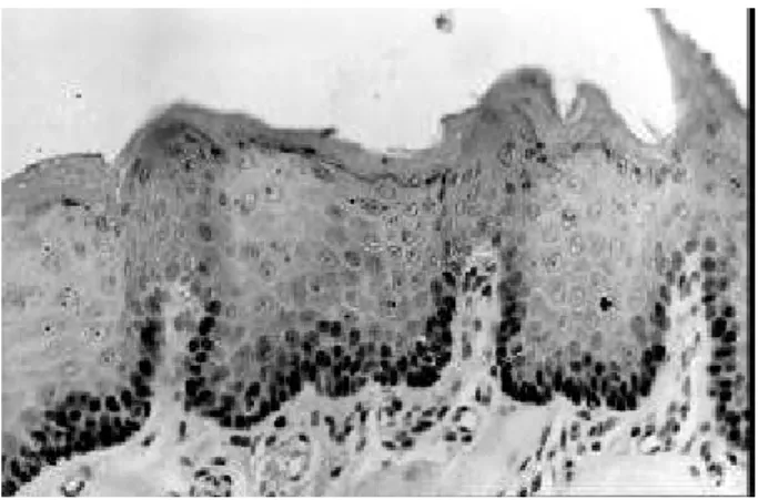 Figure 1. PCNA expression in basal and parabasal cells on the tongue mucosa of rats (streptavidin-biotin-peroxidase complex stain, original magnification 400X).