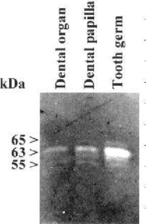 Figure 3. Expression of MMP-2 in rat first molar tooth germ. (A) Total RNA isolated from first molar tooth germs was subjected to RT- RT-PCR assays using specific primers for MMP-2