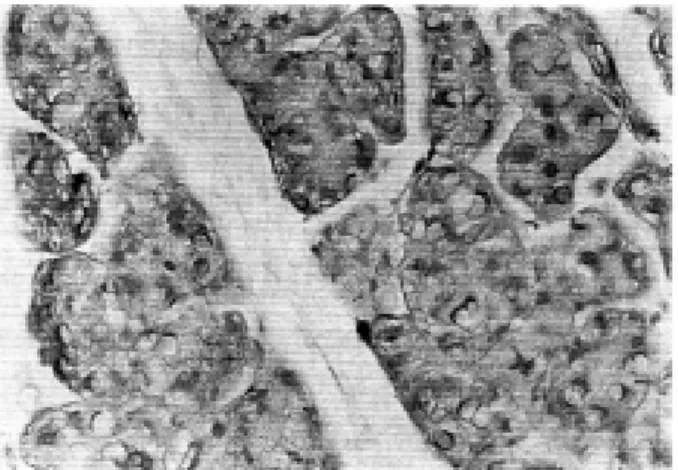 Figure 6. Experimental group. Histological aspect of the parotid gland from rats fed a liquid diet for 30 days